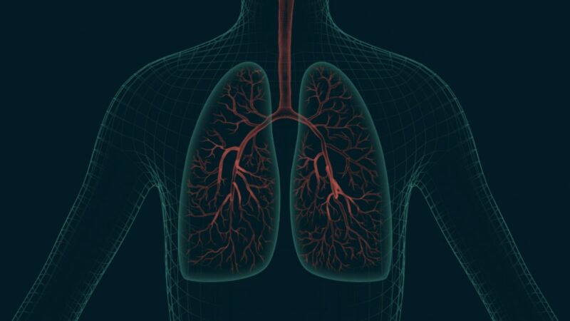 Interstitial Lung Diseases