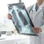 The Four Stages of COPD Explained