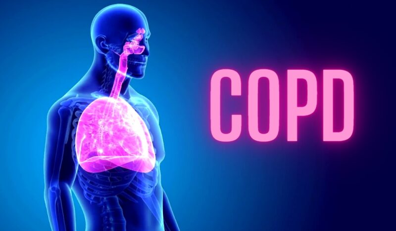 End-Stage or Advanced COPD
