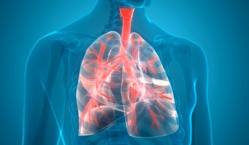 Progression and Impact on Lung Function